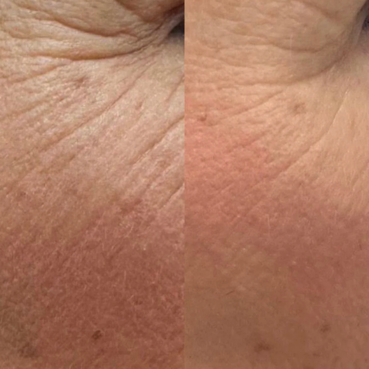 IDENEL - Brightening Skin