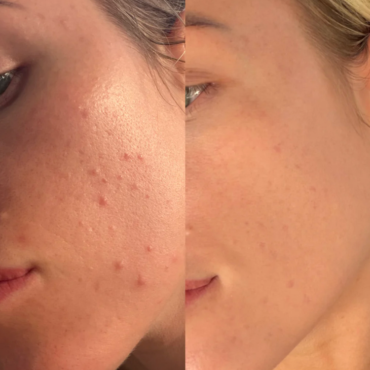 IDENEL - Glass Skin Reset Kit - Launch Price $540 (RRP $640)