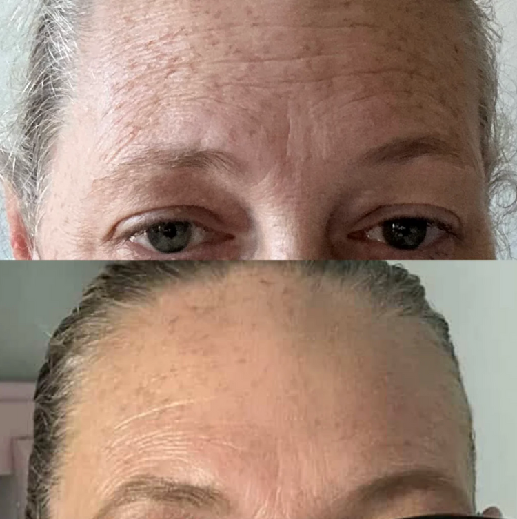 IDENEL - Glass Skin Reset Kit - Launch Price $540 (RRP $640)