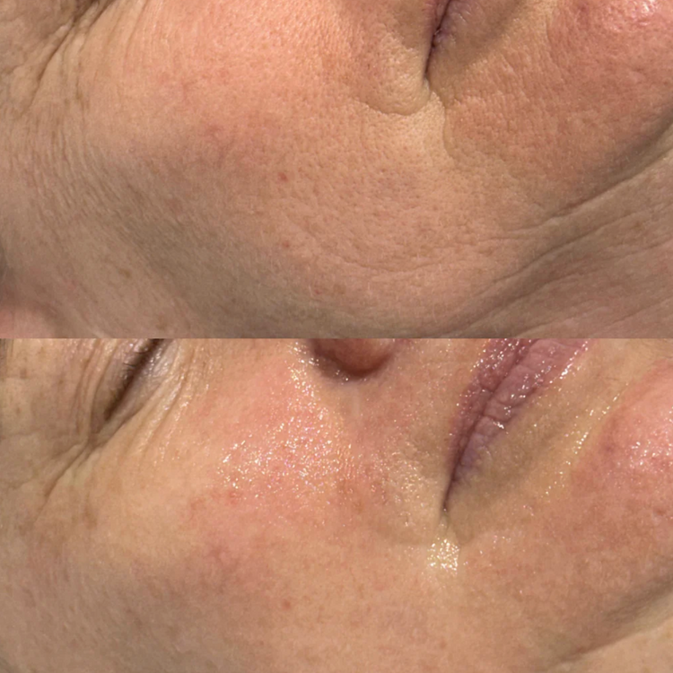 IDENEL - Revitalizing Nourishing Cream