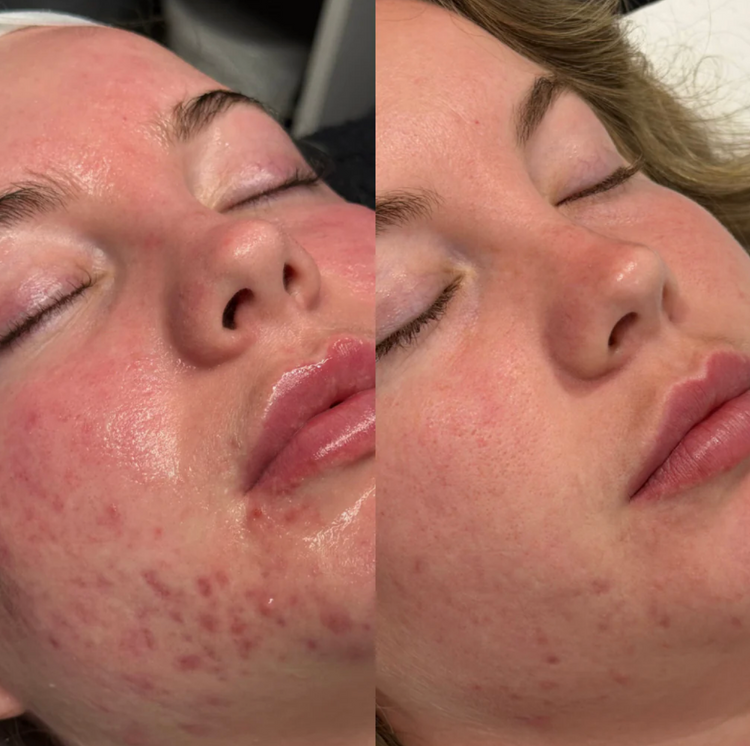 IDENEL - Revitalizing Boosting Serum